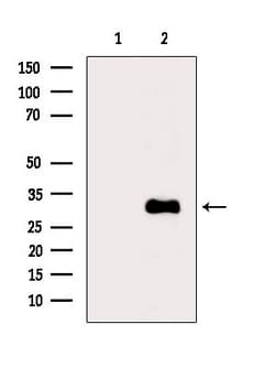Invitrogen ACOT8 Polyclonal Antibody 100 &mu;L | Buy Online | Invitrogen&trade; | Fisher Scientific