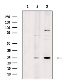 Invitrogen LYPLA1 Polyclonal Antibody 100 &mu;L; Unconjugated:Antibodies,