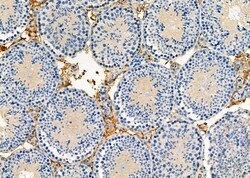 Invitrogen LPCAT2 Polyclonal Antibody 100 &mu;L; Unconjugated:Antibodies,