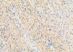 Invitrogen LPCAT2 Polyclonal Antibody 100 &mu;L; Unconjugated:Antibodies,