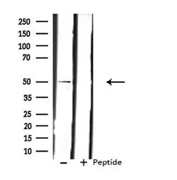 Invitrogen LPCAT2 Polyclonal Antibody 100 &mu;L; Unconjugated:Antibodies,