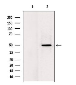 Invitrogen LPCAT2 Polyclonal Antibody 100 &mu;L; Unconjugated:Antibodies,