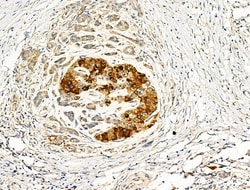 Invitrogen ADAMTS18 Polyclonal Antibody 100 &mu;L; Unconjugated:Antibodies,