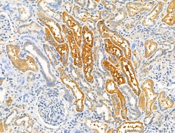 Invitrogen ADAMTS18 Polyclonal Antibody 100 &mu;L; Unconjugated:Antibodies,