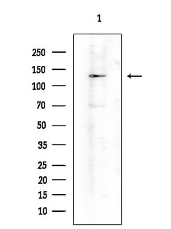 Invitrogen ADAMTS18 Polyclonal Antibody 100 &mu;L; Unconjugated:Antibodies,
