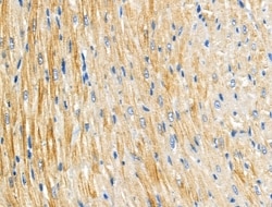 Invitrogen ARL2BP Polyclonal Antibody 100 &mu;L; Unconjugated:Antibodies,