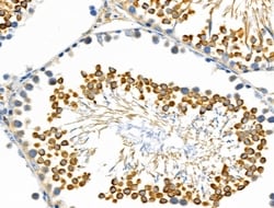 Invitrogen ARL2BP Polyclonal Antibody 100 &mu;L; Unconjugated:Antibodies,