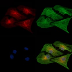 Invitrogen ALDH1B1 Polyclonal Antibody 100 &mu;L | Buy Online | Invitrogen&trade; | Fisher Scientific