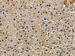 Invitrogen ALDH1B1 Polyclonal Antibody 100 &mu;L | Buy Online | Invitrogen&trade; | Fisher Scientific