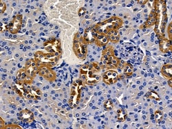 Invitrogen ALDH1B1 Polyclonal Antibody 100 &mu;L | Buy Online | Invitrogen&trade; | Fisher Scientific