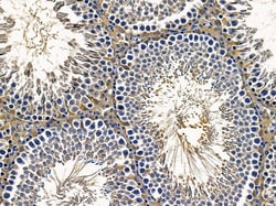 Invitrogen ALDH1B1 Polyclonal Antibody 100 &mu;L | Buy Online | Invitrogen&trade; | Fisher Scientific