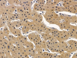 Invitrogen ALDH1B1 Polyclonal Antibody 100 &mu;L | Buy Online | Invitrogen&trade; | Fisher Scientific