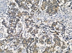 Invitrogen AKR1C2 Polyclonal Antibody 100 &mu;L; Unconjugated:Antibodies,