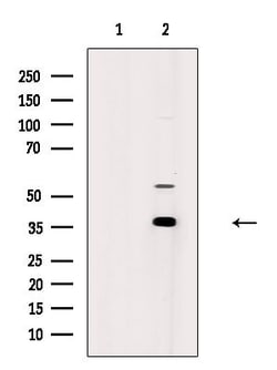 Invitrogen AKR1C2 Polyclonal Antibody 100 &mu;L; Unconjugated:Antibodies,