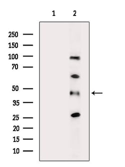 Invitrogen AKR1C2 Polyclonal Antibody 100 &mu;L; Unconjugated:Antibodies,