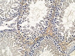 Invitrogen SCNN1D Polyclonal Antibody 100 &mu;L; Unconjugated:Antibodies,