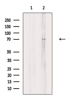 Invitrogen SCNN1D Polyclonal Antibody 100 &mu;L; Unconjugated:Antibodies,