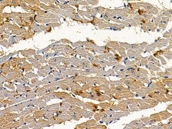 Invitrogen Amphiphysin Polyclonal Antibody 100 &mu;L; Unconjugated:Antibodies,