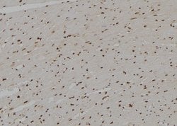 Invitrogen APBB2 Polyclonal Antibody 100 &mu;L; Unconjugated:Antibodies,