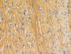 Invitrogen APBB2 Polyclonal Antibody 100 &mu;L; Unconjugated:Antibodies,