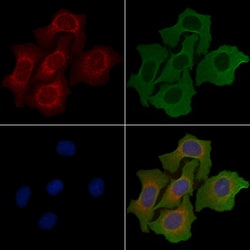 Invitrogen AIG1 Polyclonal Antibody 100 &mu;L; Unconjugated:Antibodies,