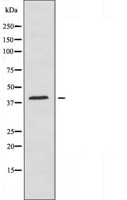Apolipoprotein A5 Polyclonal Antibody:Antibodies, Polyclonal