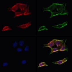 Invitrogen ATP5H Polyclonal Antibody 100 &mu;L; Unconjugated:Antibodies,