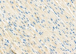 Invitrogen ATP5H Polyclonal Antibody 100 &mu;L; Unconjugated:Antibodies,