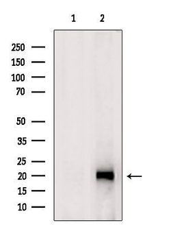 Invitrogen ATP5H Polyclonal Antibody 100 &mu;L; Unconjugated:Antibodies,