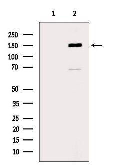 Invitrogen ABCA8 Polyclonal Antibody 100 &mu;L | Buy Online | Invitrogen&trade; | Fisher Scientific