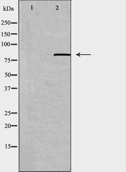 Invitrogen ABCB7 Polyclonal Antibody 100 &mu;L; Unconjugated:Antibodies,