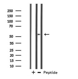 Invitrogen DDX19B Polyclonal Antibody 100 &mu;L; Unconjugated:Antibodies,