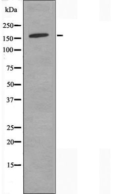Invitrogen DHX8 Polyclonal Antibody 100 &mu;L; Unconjugated:Antibodies,