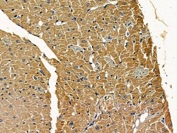 Atrophin 1 Polyclonal Antibody, Invitrogen 100 &mu;L; Unconjugated:Antibodies,