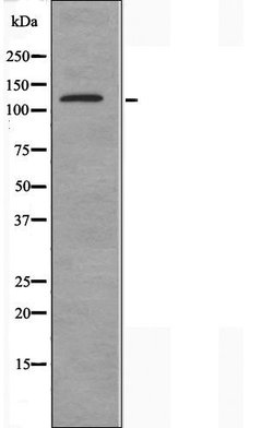 Atrophin 1 Polyclonal Antibody, Invitrogen 100 &mu;L; Unconjugated:Antibodies,