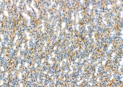 Invitrogen BNIP2 Polyclonal Antibody 100 &mu;L; Unconjugated:Antibodies,