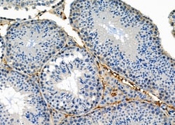 Invitrogen BNIP2 Polyclonal Antibody 100 &mu;L; Unconjugated:Antibodies,