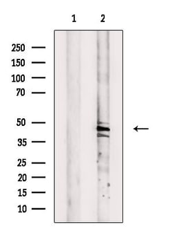 Invitrogen GCNT6 Polyclonal Antibody 100 &mu;L; Unconjugated:Antibodies,