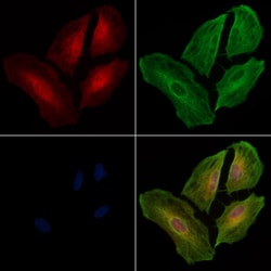 Invitrogen B3GALT1 Polyclonal Antibody 100 &mu;L; Unconjugated:Antibodies,