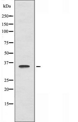 Invitrogen B3GALT1 Polyclonal Antibody 100 &mu;L; Unconjugated:Antibodies,
