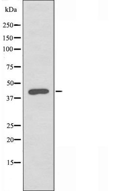 Invitrogen B3GALT4 Polyclonal Antibody 100 &mu;L | Buy Online | Invitrogen&trade; | Fisher Scientific