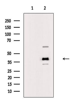 Invitrogen B4GALT5 Polyclonal Antibody 100 &mu;L; Unconjugated:Antibodies,