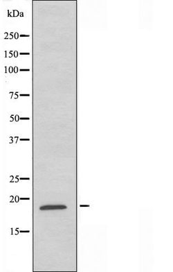 Invitrogen GUSBP1 Polyclonal Antibody 100 &mu;L; Unconjugated:Antibodies,