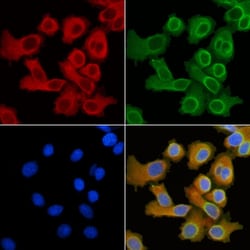 Invitrogen SLC27A5 Polyclonal Antibody 100 &mu;L; Unconjugated:Antibodies,