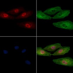 BCAS2 Polyclonal Antibody:Antibodies, Polyclonal