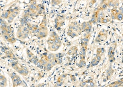 Invitrogen CHP2 Polyclonal Antibody 100 &mu;L; Unconjugated:Antibodies,