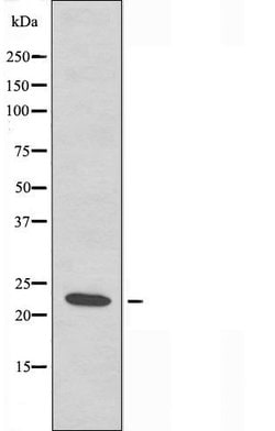 Invitrogen CHP2 Polyclonal Antibody 100 &mu;L; Unconjugated:Antibodies,
