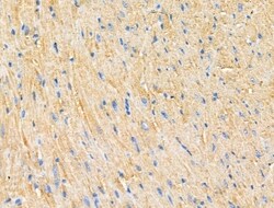 Invitrogen PNPLA8 Polyclonal Antibody 100 &mu;L; Unconjugated:Antibodies,