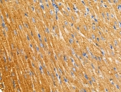 Invitrogen PNPLA8 Polyclonal Antibody 100 &mu;L; Unconjugated:Antibodies,