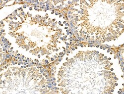 Invitrogen PNPLA8 Polyclonal Antibody 100 &mu;L; Unconjugated:Antibodies,